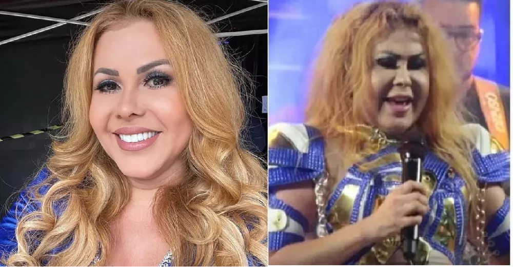 Joelma é internada e passa por exames para o tratamento das sequelas da covid