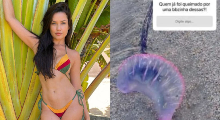 Juliette sofre queimadura de água-viva: ‘Pense em uma dor’